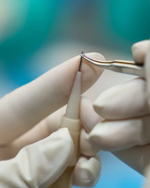 DHI Hair Transplant Technique Image