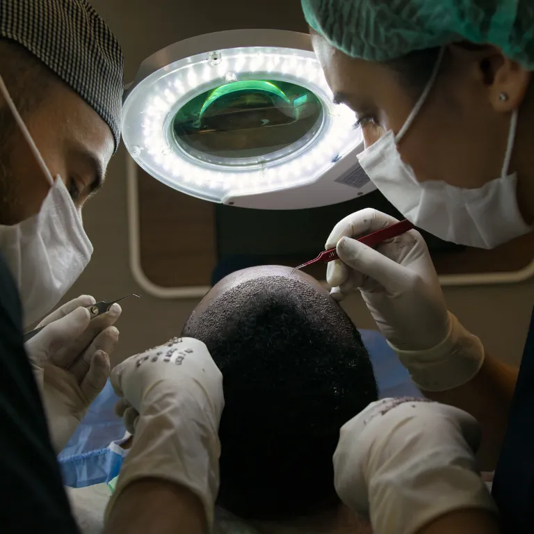 FUE Hair Transplant Technique Image